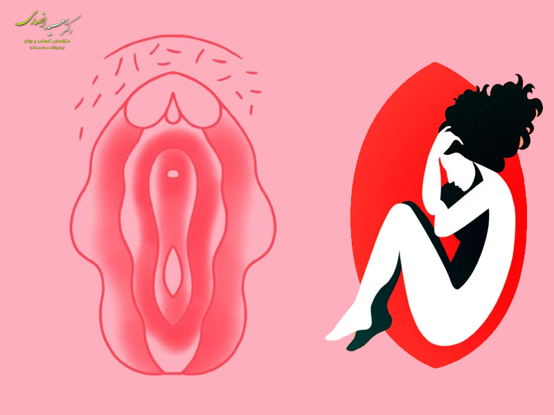 واژینیسموس